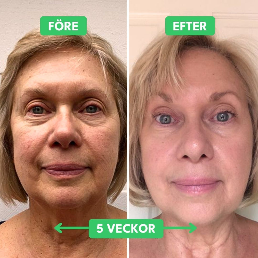 Glåmig hud? Få tillbaka glow på 14 dagar.