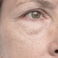 4)
När huden känns trött och glåmig.
Skonsam rengöring + fukt + olja ger en fräschare, mer “levande” hud.