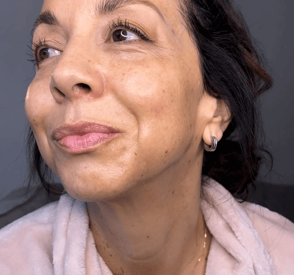 Retinol Boost Image