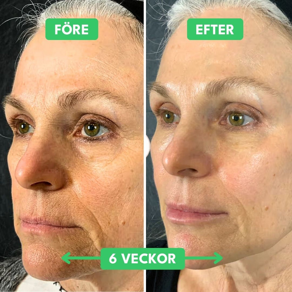 Torr hud som stramar? Det här lugnar direkt.