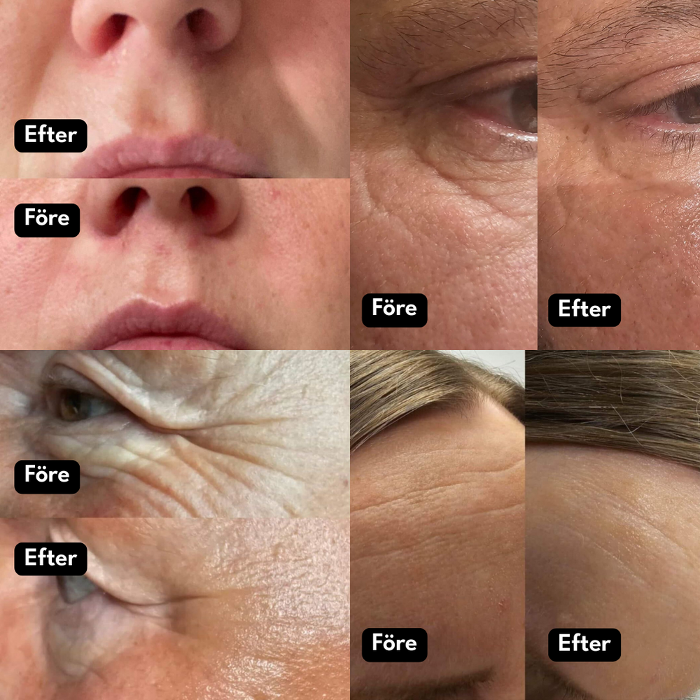 Minska fina linjer & rynkor (utan att torka ut)